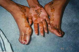 Mendhi